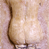 Bondage